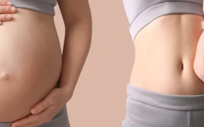 Your Postpartum Recovery And If Pelvic Floor Physical Therapy Is Right For You