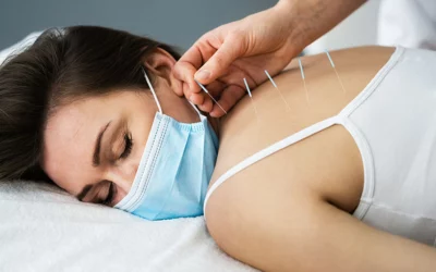 What’s The BUZZ Around Dry Needling And Can It Help Me?